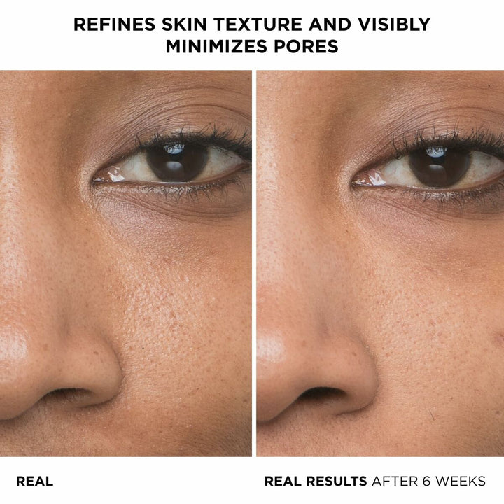 V3HF2281436D8A6B60CE932DF778EB98B34R6238555P2